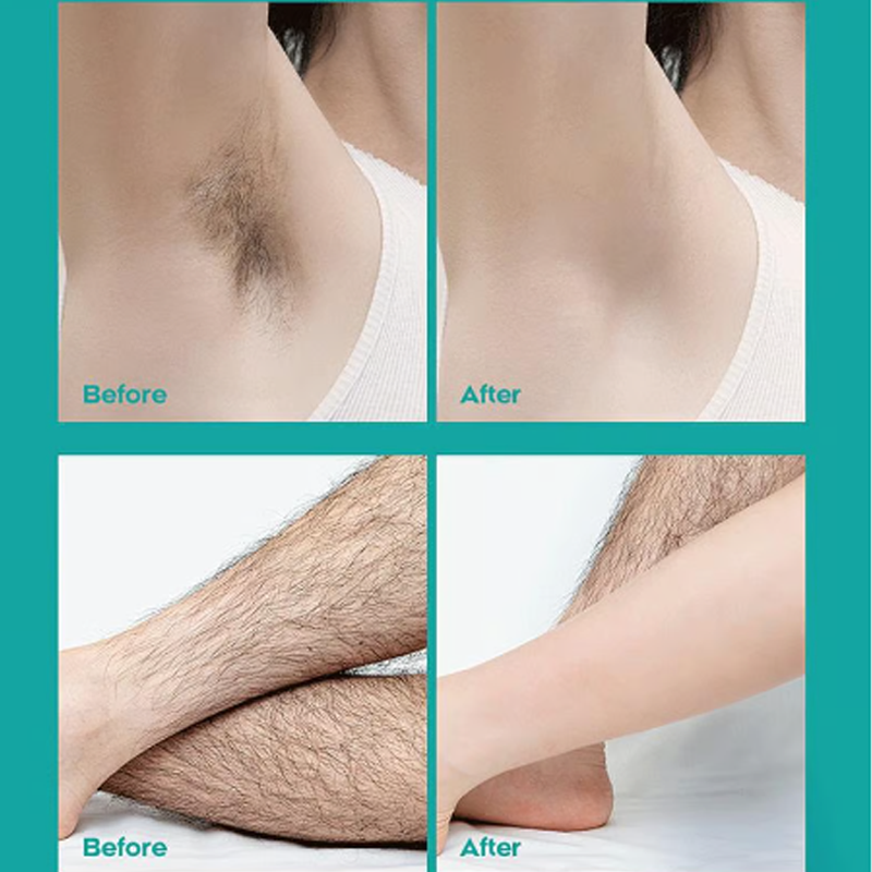 🔥Crema depilatoria indolore per tutto il corpo, per uomo e donna – Delicata su tutte le zone del corpo